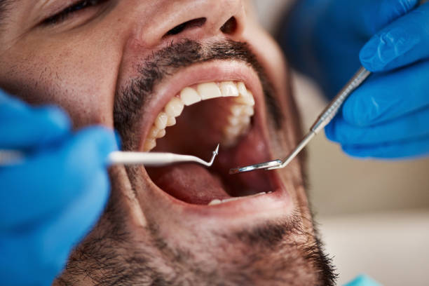 Oral Cancer Screening in Versailles, IN